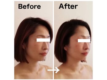 フィオーレ/【★サウナ+小顔・むくみケア】