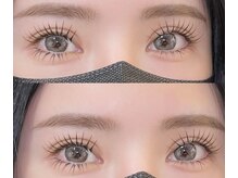 エイシェル/＆healthyアンドヘルシー100本