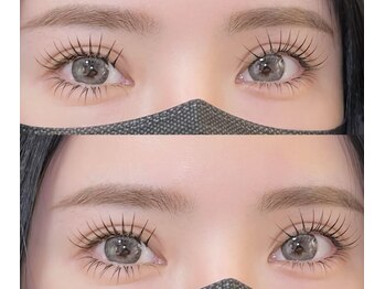 エイシェル/＆healthyアンドヘルシー100本