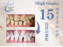 ラフ(LAUGH)/【審・美・白】 ホワイトニング