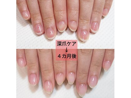 ネイルユー(Nail U)の写真