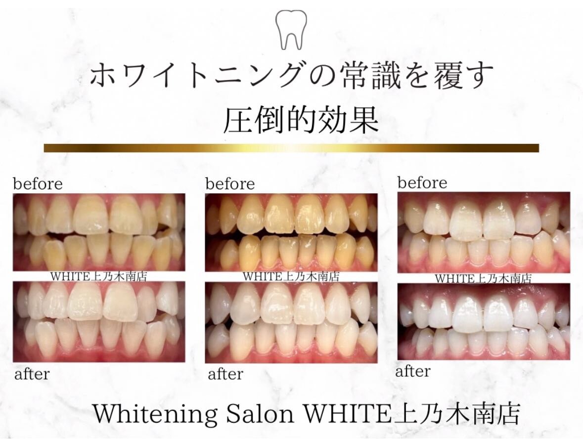 ホワイト 上乃木南店(WHITE)｜ホットペッパービューティー