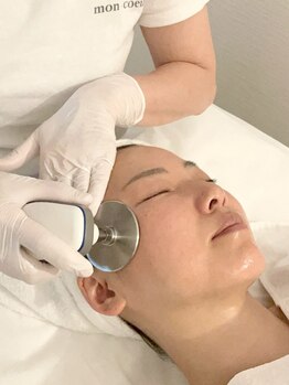 モンクール(mon coeur)の写真/30代後半からのむくみ・たるみケアに★インディバフェイシャルで理想の小顔に♪