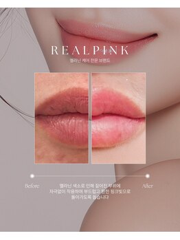 アネラ(ANELA)/Real Pink