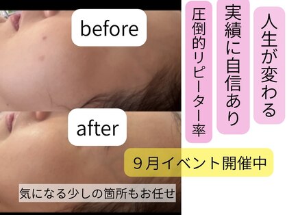 サロン ドロップ 上小田井(Salon drop)の写真