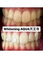 アクア 天王寺店(AQUA) ホワイトニング/ホワイトニング専門店/天王寺/ホワイトニング