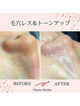 フルーヴ ルフレ(Fleuve Reflet)/毛穴管理はじめませんか？