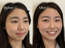 リタ(Lita.)の雰囲気（アミノ酸まつげパーマとのセットメニューが人気です）