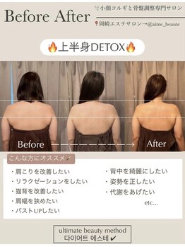 アイミーボーテ(Aime beaute)/ブライダルエステ