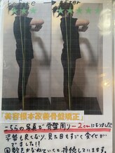 ラクラク(rakuraku)/【美容根本改善骨盤矯正】