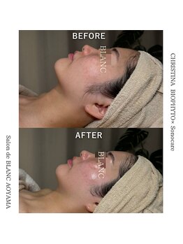 サロン ド ブラン アオヤマ(Salon de BLANC AOYAMA)/BIOPHYTO×Sonocare