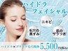 <初回限定>【ハイドラ×プラズマ毛穴洗浄】　￥6600→￥5500