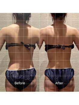 ドットカノア(.Kanoa)/お客様のbefore/after