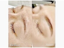 フリル(FRILL)の雰囲気（今話題のハリウッドブロウリフト◆）