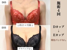 ソワ(soie)/太らずにサイズアップ達成