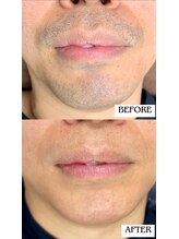 バディーズ(BUDDieS)/40代