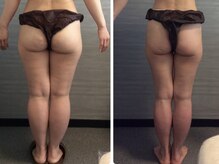 美容整体 ウェリナ 蟹江院/小顔矯正/骨盤矯正/美脚サロン 