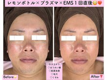 エスポワール(Espoir)の雰囲気（レモンボトル導入致しました♪×プラズマ×EMS効果最強です！）