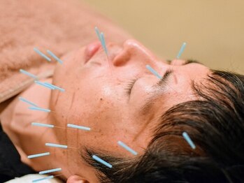 鍼灸院リビング(Living)の写真/画面越しの自分にハッとしたら。30代からのメンズ美容鍼灸◎引き締まったフェイスラインでデキる男へ！