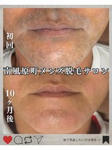 シック 南風原店(Chic)/頑固なヒゲも抜けます！