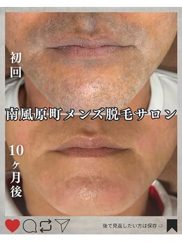 シック 南風原店(Chic)/頑固なヒゲも抜けます！