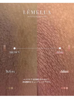 オニュ(onyu)/人気No,2 デリケートゾーンケア