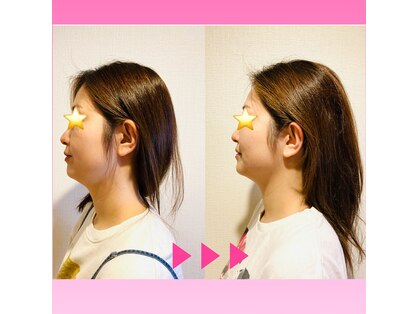 セルフィッシュ(Cellfish)の写真