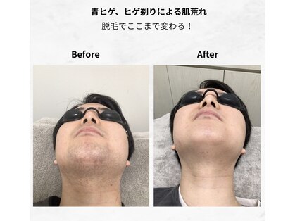 マリーローラン メンズルイズ(Marryrolan MensRuise)の写真