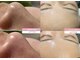 ルフル(rufleu)の写真