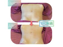 ラジェニアテンアンズ(Rajeunir 10 ans)/内臓冷えは危険信号！