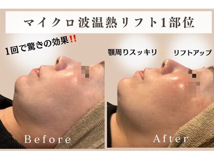 インナーグロウ 中目黒(INNER GLOW)の写真