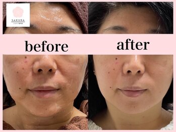 サクラ(SAKURA)/40代後半◎透明感で女性らしく◎