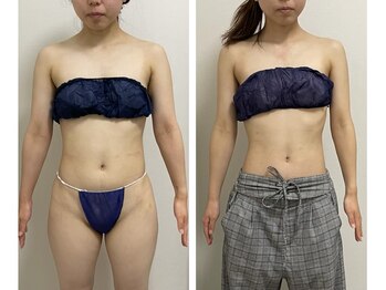 ハピネスビューティーサロン(happiness beauty salon)/WINBACK症例