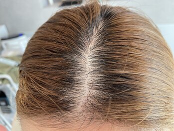 トウキ(TOUKI)/強髪プログラム