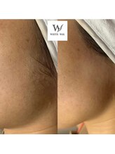 ホワイトワックス 京都四条烏丸(WHITE WAX)/もみあげデザイン　WAX