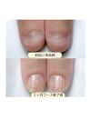 自爪育成・最強のネイルケア鳥取