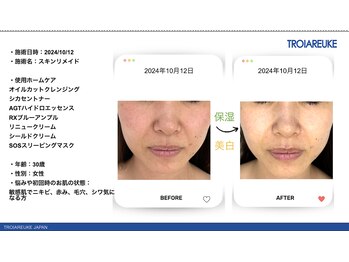 リトルーム(Litroom: from Seoul)/スキンメイド