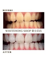 ホワイトニングショップ 新小岩店/ホワイトニング専門店