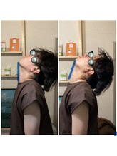 エクステンド鍼灸整体院(extend鍼灸整体院)/鍼60分　コース