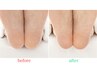 【フットケア】スパルーチェ角質ケア ￥2000 オフクーポン併用不可