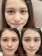 トトノウダケデ/お客様写真