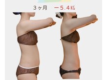 ジプソフィラ(Gypsophila)