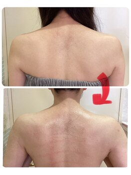 エステティックサロン ココチ(Cocochi)/新メニュー!かっさで肩甲骨を♪