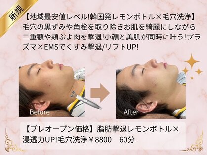 頭のオアシすぱ【毛穴×小顔×ヘッドスパ】の写真