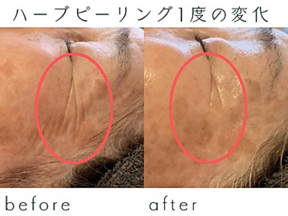 ソラ(Sora)の写真