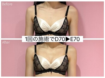 ククナ 新潟本店(KUKUNA)/*バストアップケア*