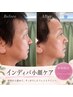 【小顔リフトアップ効果◎】たるみ・もたつきに◎インディバ小顔＋ヘッド 