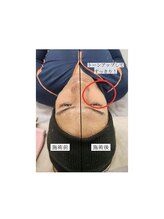 ティンクル サロン(Twinkle salon)/顔全体コース