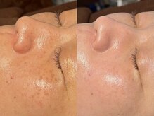 ルーナジェーナ(Luna llena)/池袋　エステ　ルーナジェーナ