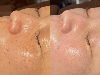 ルーナジェーナ(Luna llena)/池袋 エステ ルーナジェーナ